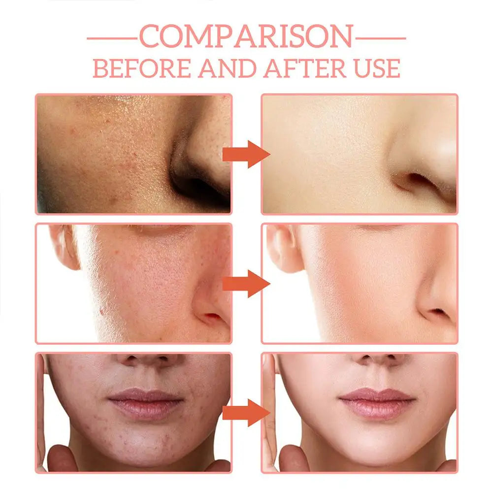 Vitamin C & Hyaluronic Acid Hydrating Serum