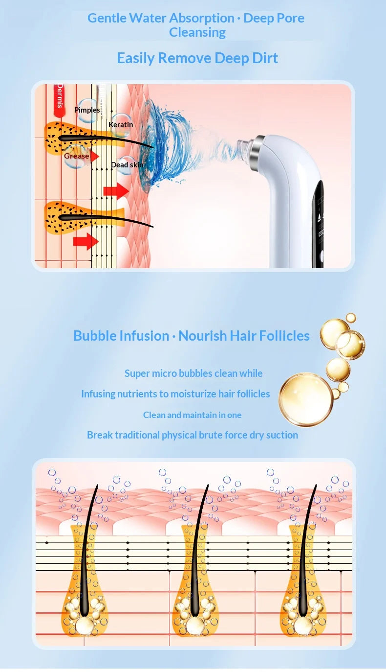 Electric Facial Pore Cleansing Device